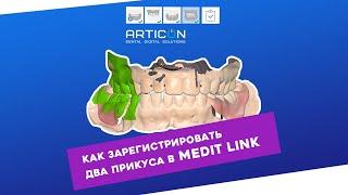 КАК ЗАРЕГИСТРИРОВАТЬ 2 ПРИКУСА В MEDIT LINK | ARTICON