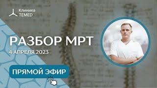 Разбор МРТ (4.04.23)