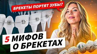 5 МИФОВ о брекетах