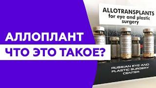 Что такое аллоплант. Только достоверная научная информация