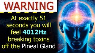 FULL PINEAL GLAND DETOX (You'll Feel Better after 1 Listen)