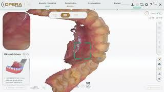 OPERA MACH2 SCANNER INTRAORAL 