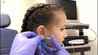 Ear Piercings (How They Are Performed in a Doctor's Office)