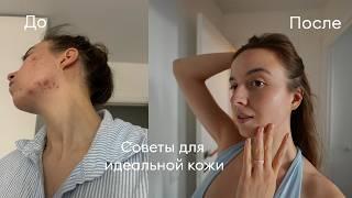 Моя история акне и советы по уходу *СМОТРЕТЬ ВСЕМ*