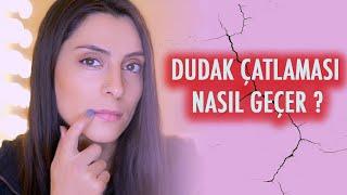 Dudak Çatlaması Nasıl Geçer | Evde Doğal Yöntemler | Güzellik - Bakım