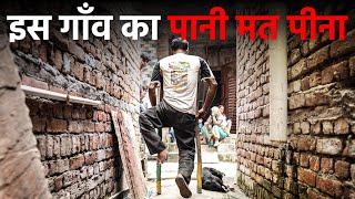 Water In This Village Is Making Its Residents Disabled ft. Anil | Jist