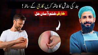 Scabies Treatment | Home Remedies | Kharish ka Elaaj