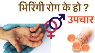 सिफलिस रोग/भिरिंगी रोग/syphilis/karan, upachar, test, aushadhi/viringi rog in nepali.