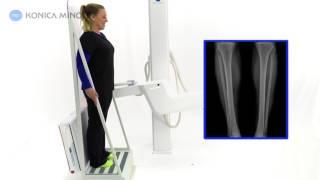 Konica Minolta Healthcare KDR Advanced U-Arm Stitching Lower Extremities