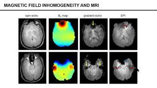 ISMRM MR Academy - Magnetic Field Shimming