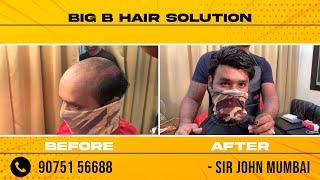 Hair Patch Replacement Service | Sir John | Big B Hair Solution | Mumbai