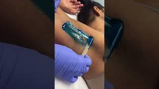 Quick professional underarm wax using hard blue wax from Starpil professional Esthetician