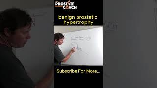 Everything you want to know about benign prostatic hypertrophy (BPH)