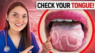 What your TONGUE says about your HEALTH: Doctor Explains