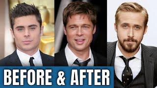 Zac Efron Face (2020): Plastic Surgery