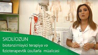 Biotənzimləyici terapiya və fizioterapevtik üsullarla SKOLİOZ aradan qaldırılır!