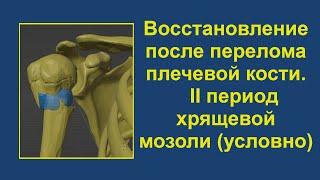 2. Восстановление после перелома верхней трети плечевой кости. Период хрящевой мозоли (условно)