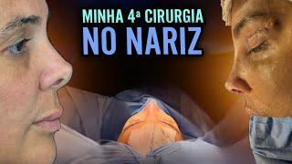 FIZ MINHA 4ª CIRURGIA NO NARIZ