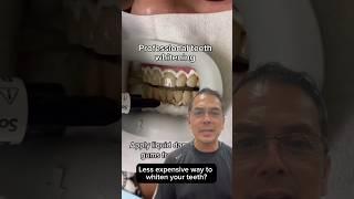 Professional Teeth Whitening vs Hydrogen Peroxide EXPLAINED | In Office to Hands On Dental Training