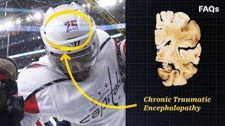 CTE: Why this brain disease is more common than you think