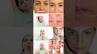 Face exercises to lift saggy skin #faceyoga
