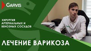 Лечение варикоза в клинике GARVIS