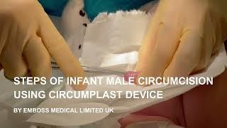 Innovative Circumplast device for male infant circumcision