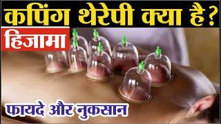 कपिंग थेरेपी क्या है ? Cupping Therapy Benefits | Hijama Therapy