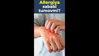 Allergiyani sababi tumovmi?