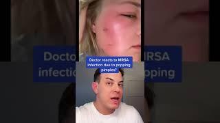 Popping a pimple caused this!  | 208SkinDoc
