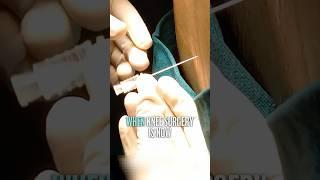 SpinE Injection Nerve Block #shorts