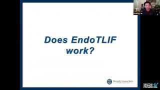 24   Endoscopic Lumbar Fusion   Choll W  Kim, MD, PhD