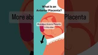 What is Anterior Placenta? #pregnant