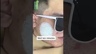 Green Mask Stick Viral Video (Order Link in Description)