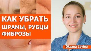 Как убрать рубцы и шрамы на коже. Шрамы после прыщей, рубцы на теле и другие фиброзы