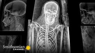 X-Ray of an Ancient Mummy Reveals Details of Noblewoman's Life   | Smithsonian Channel