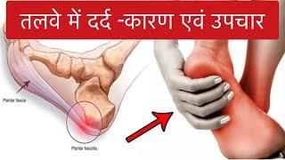 तलवे में दर्द -कारण और उपचार (हिंदी में)। Plantar fasciitis- Reason,symptoms,and treatment in hindi