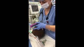 3 bebe Vie Intubations 720 dpi