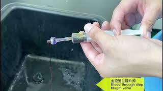 Application of duckbill valve in hemodialysis pipeline#medical #medicare