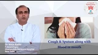 Dr Nitin Rathi, Senior Pulmonologist ,Dharamshila Narayana Hospital, Delhi