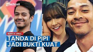 Pemeran Pria di Video Syur Mirip Gisel Disebut Pakar Mudah Ditelusuri, Ada Tanda di Pipi Kanan