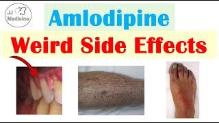 Amlodipine Weird Side Effects (Skin, Gastrointestinal, Psychological)