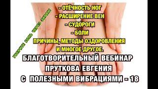 ВАРИКОЗ, ОТЁЧНОСТЬ, СУДОРОГИ, РАЗЛИЧНЫЕ БОЛИ. ЦЕЛЕБНЫЕ  ВИБРАЦИИ ПРУТКОВА ЕВГЕНИЯ - 18