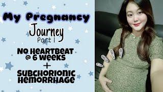 My Pregnancy Journey Part 1| No Heartbeat at 6 weeks | Subchorionic Hemorrhage | Gender reveal 