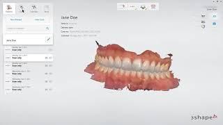 Exporting STL file from TRIOS