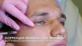 Ботулинотерапия верхней трети лица