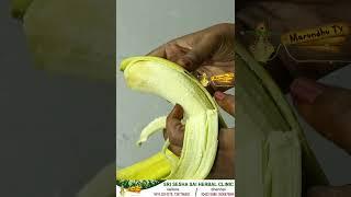 அல்சர் போன்ற பல நோய்களுக்கு மருந்தாகும் மலை வாழை