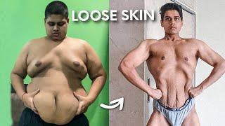 How To Avoid Sagging Loose Skin During Weight Loss Transformation