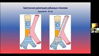 3 Русаков М.А.  Рубцовые стенозы трахеи