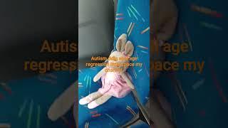 special needs autistic autism on the bus abdl age regression